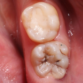 Фото з портфоліо фахівця Владислав Вячеславович Поник (ортодонт, Київ)