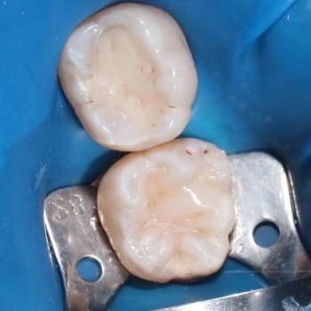 Фото з портфоліо фахівця Владислав Вячеславович Поник (ортодонт, Київ)