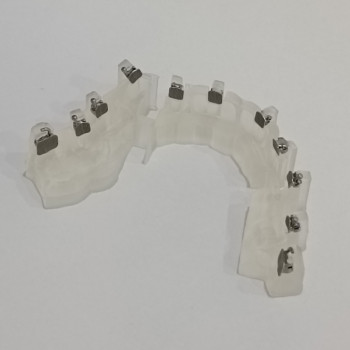 Фото з портфоліо фахівця Владислав Вячеславович Поник (ортодонт, Київ)