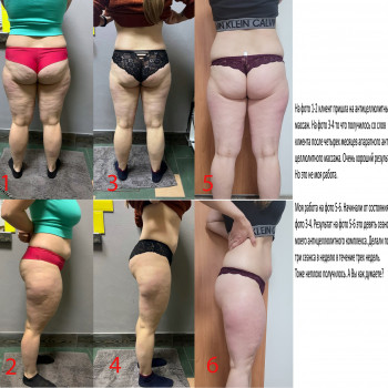 Володимир Бігун, Чернігів Фото - 6