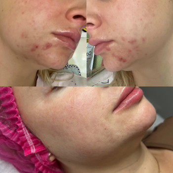 Анна Хмелюк, Полтава Фото - 5