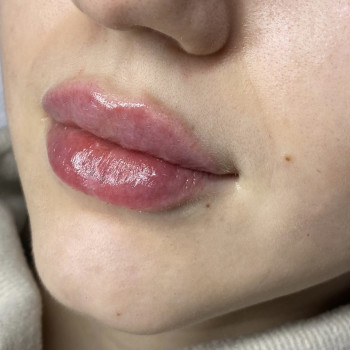 Анна Хмелюк, Полтава Фото - 6