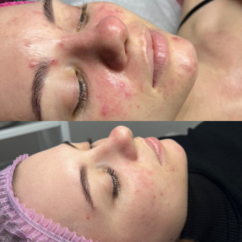 Анна Хмелюк, Полтава Фото - 7