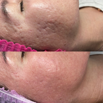 Анна Хмелюк, Полтава Фото - 8