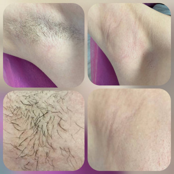 Ірина Супрун, Бровары Фото - 5