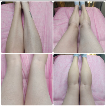 Ірина Супрун, Бровары Фото - 6