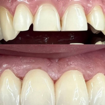 Diamant Dental, Черкассы Фото - 5