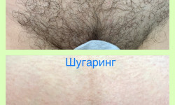 Шугаринг бикини Майстер з пірсингу Татьяна Київ