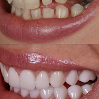 Центр стоматології Голобородько, Черкассы Фото - 6