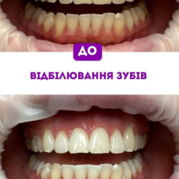 Magic Smile, Черкаси Фото - 5