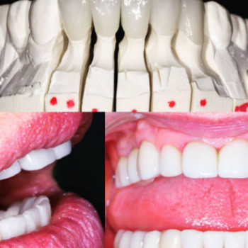 Експрес-стоматос, Черкаси Фото - 5