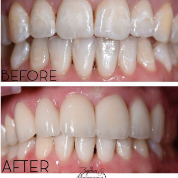 Зубна Майстерня, Харків Фото - 5