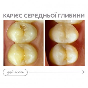 Aven Ezer, Харьков Фото - 5