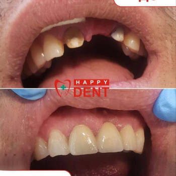 Happy-dent, Харьков Фото - 5