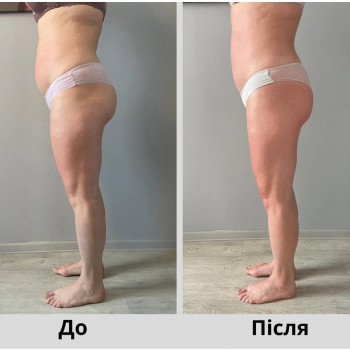 Антон Рижов, Харків Фото - 8