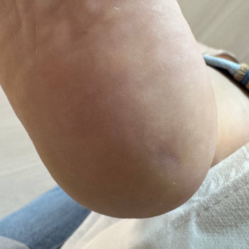 Педикюр апаратний/комбі (гіпєнічна обробка стоп та пальчиків)
                    Ногтевая студия Маникюрный дом Одесса