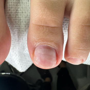 Естетичний апаратний/ комбі педикюр (обробка тільки пальчиків)
                    Ногтевая студия Маникюрный дом Одесса