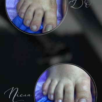 Фото з портфоліо фахівця Анастасія Нагорна (подолог, Харків)