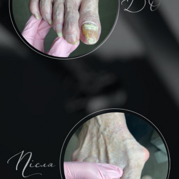 Фото з портфоліо фахівця Анастасія Нагорна (подолог, Харків)