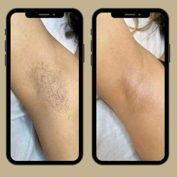 Ганна Зусева, Харків Фото - 5