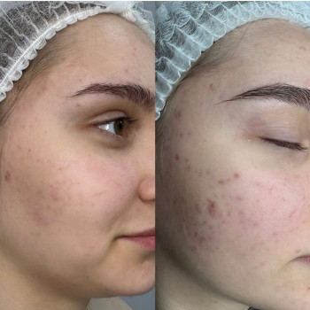 Виктория Анахина, Харьков Фото - 5