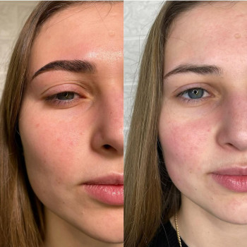 Діана Гопаненко, Харків Фото - 6