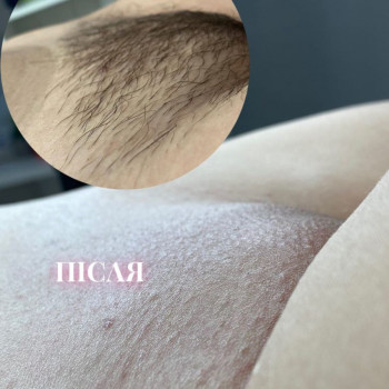 Анна Пономаренко, Харьков Фото - 5