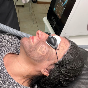 Карбоновий пілінг
                    Майстер перманентного макіяжу Виктория Кривий Ріг