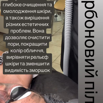 Карбоновий пілінг
                    Майстер перманентного макіяжу Виктория Кривий Ріг