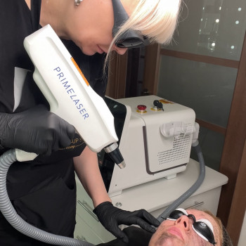 Карбоновий пілінг
                    Майстер перманентного макіяжу Виктория Кривий Ріг