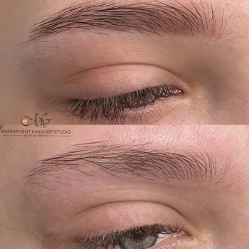 Видалення тату та перманентного макіяжу Лазер/ ремувер
                    Мастер перманентного макияжа Виктория Кривой Рог