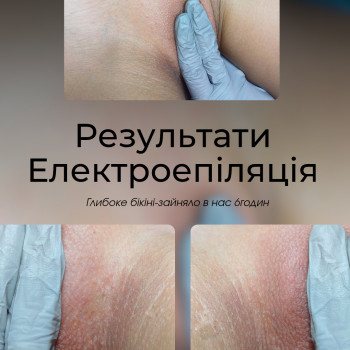 Анна Чорній, Черкаси Фото - 8