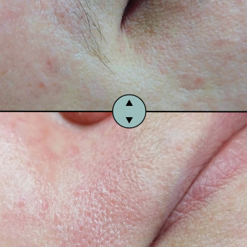 Анна Чорній, Черкаси Фото - 7