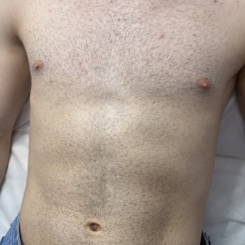 Чоловіча депіляція
                    Мастер восковой депиляции  Черновцы