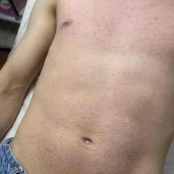 Чоловіча депіляція
                    Мастер восковой депиляции  Черновцы