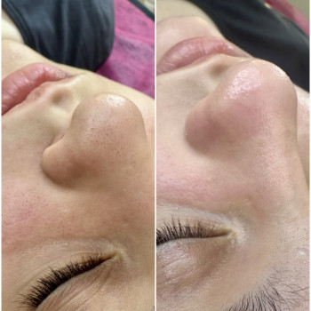 Вікторія Колісник, Полтава Фото - 5