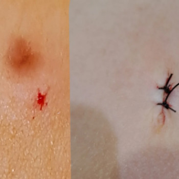 Санадерм, Черновцы Фото - 5