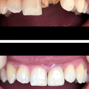 LiaDent, Черновцы Фото - 5