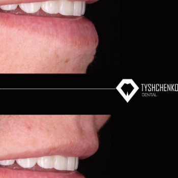 Tyshchenko, Черновцы Фото - 5