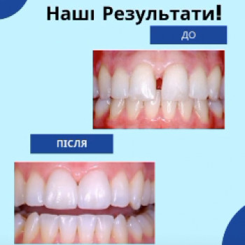 Стоматолог на Бульваре, Черновцы Фото - 5