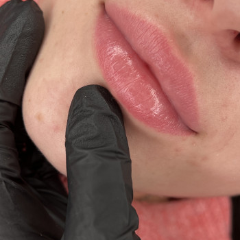 Як заживші губи після ПМ