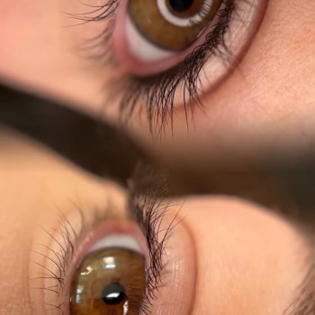 Перманент міжвійної зони