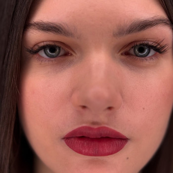 ПМ губ відразу після процедури