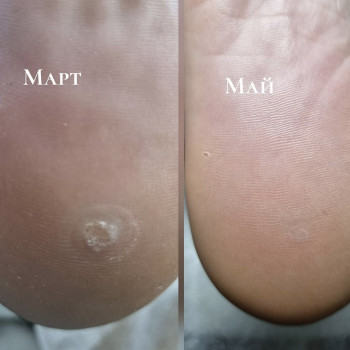 Наталья Балаховская, Кременчуг Фото - 33