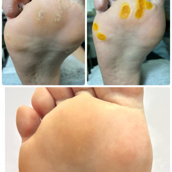 Наталья Балаховская, Кременчуг Фото - 30