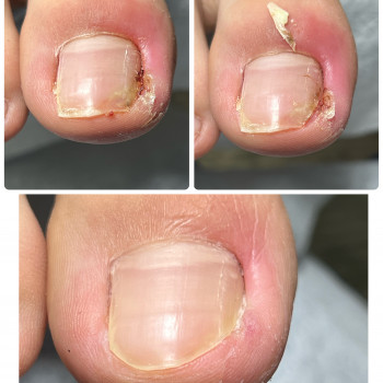 Подология
                    Мастер маникюра Наталья Кременчуг