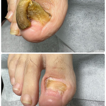 Подология
                    Мастер маникюра Наталья Кременчуг