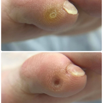 Подология
                    Мастер маникюра Наталья Кременчуг