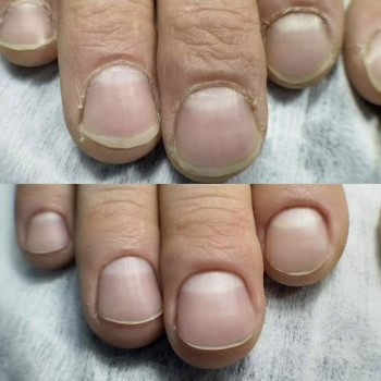 Манікюр
                    Майстер манікюру Наталья Кременчук