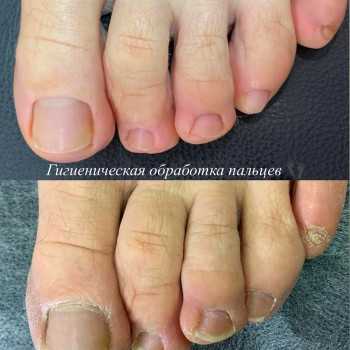 Педикюр
                    Мастер маникюра Наталья Кременчуг